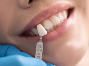 Dental Implants Paid for by Medicare