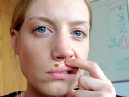 Do This Immediately If You Have Moles Or Skin Tags, It's Genius