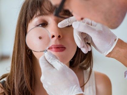 Κάντε το αμέσως εάν έχετε ετικέτες Moles ή Skin