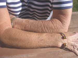 Top Nutritionist: "Crepey Skin Comes Down To This 1 Protein"