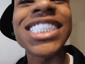 60 Second Ritual Rebuilds Your Teeth and Gums (Watch)