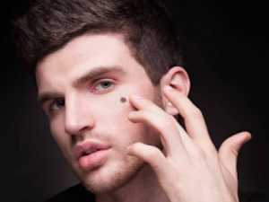 Removing Moles & Skin Tags Has Never Been This Easy