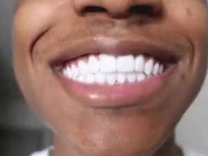 The Best Dental Implant Options in Brandon. See the List.