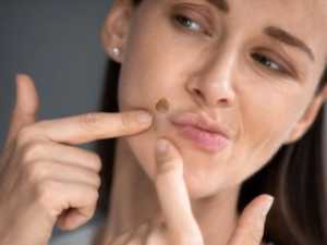 Doctors Baffled: Do This Immediately If You Have Moles Or Skin Tags, It's Genius