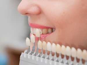 Dental Implants Costs Are Going Down in 2021. the Final Price Might Surprise You