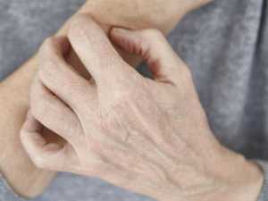 Hep C Warnings People May Want to Catch Before They Progress